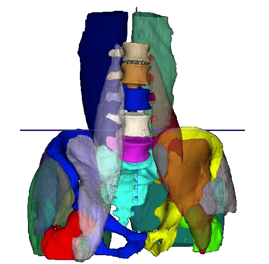 3D Segmentation